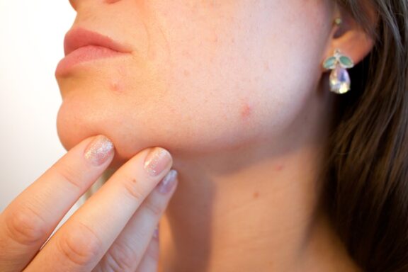 More Than Skin Deep: Everything You Need to Know About Dermatology