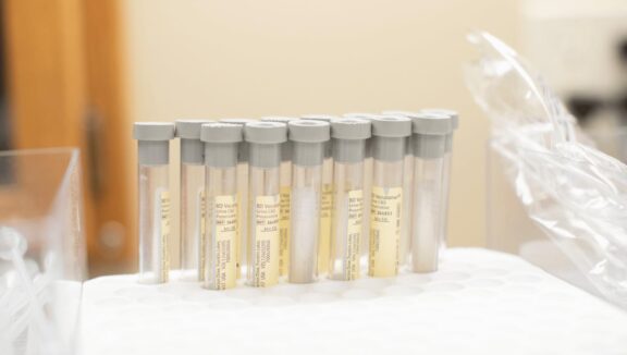 Sample tubes supports diabetes management through regular laboratory testing for key health indicators.