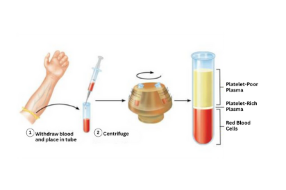 How PRP works